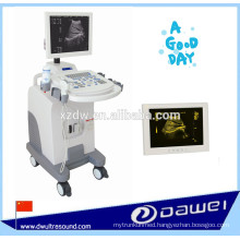 Trolley Full -Digital ultrasound machine with vaginal probe